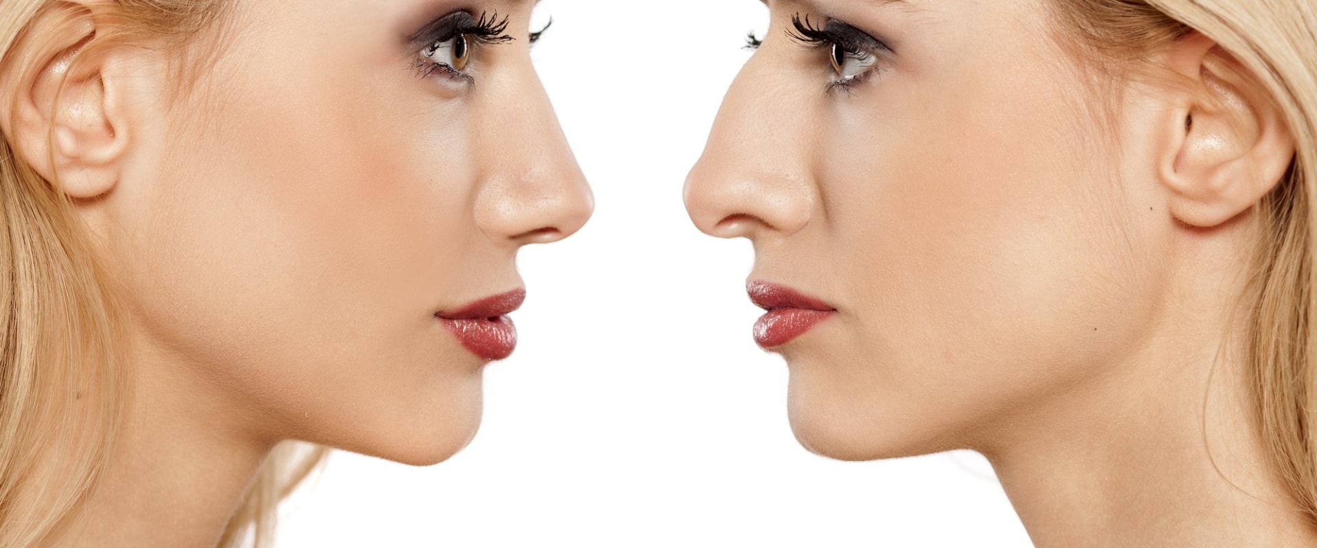 What plastic surgery has the hardest recovery?