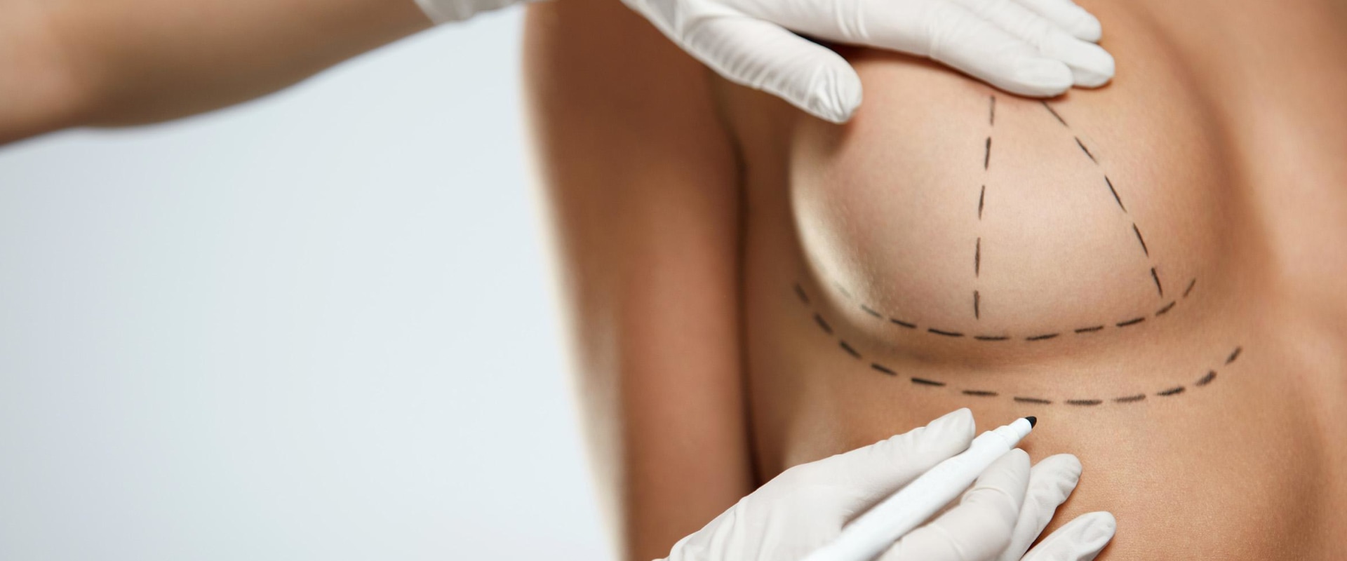 Correcting Physical Imperfections: Enhance Your Appearance with Cosmetic Surgery