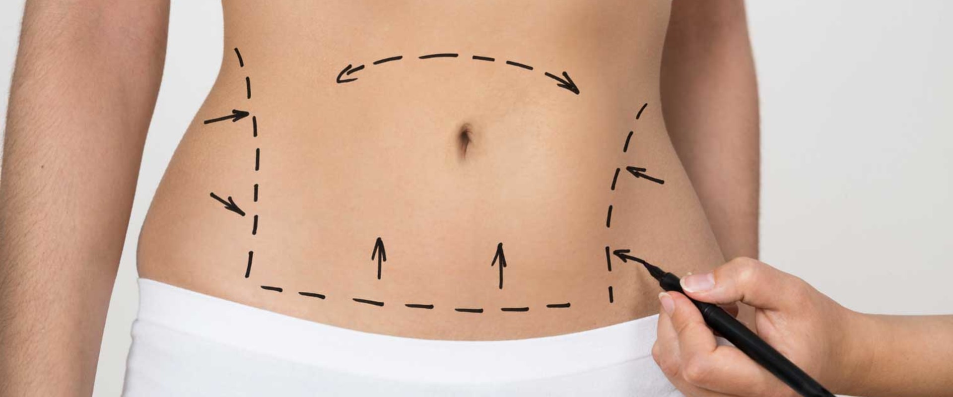 What is the satisfaction rate with tummy tuck?