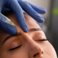 Is botox considered a medical treatment?