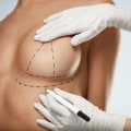 Correcting Physical Imperfections: Enhance Your Appearance with Cosmetic Surgery