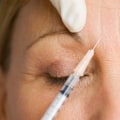 Is botox considered cosmetic surgery?