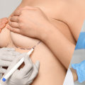 Breast Augmentation: Enhance Your Appearance with Safe and Effective Cosmetic Surgery