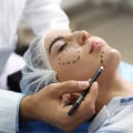 What is classed as cosmetic surgery?