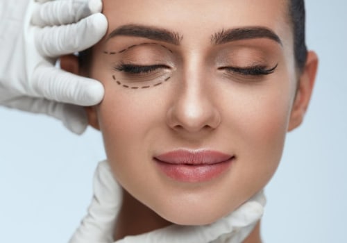 What is the most common facial plastic surgery?